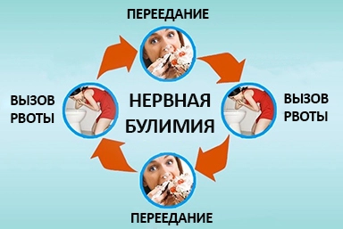 Лечение булимии в Охе